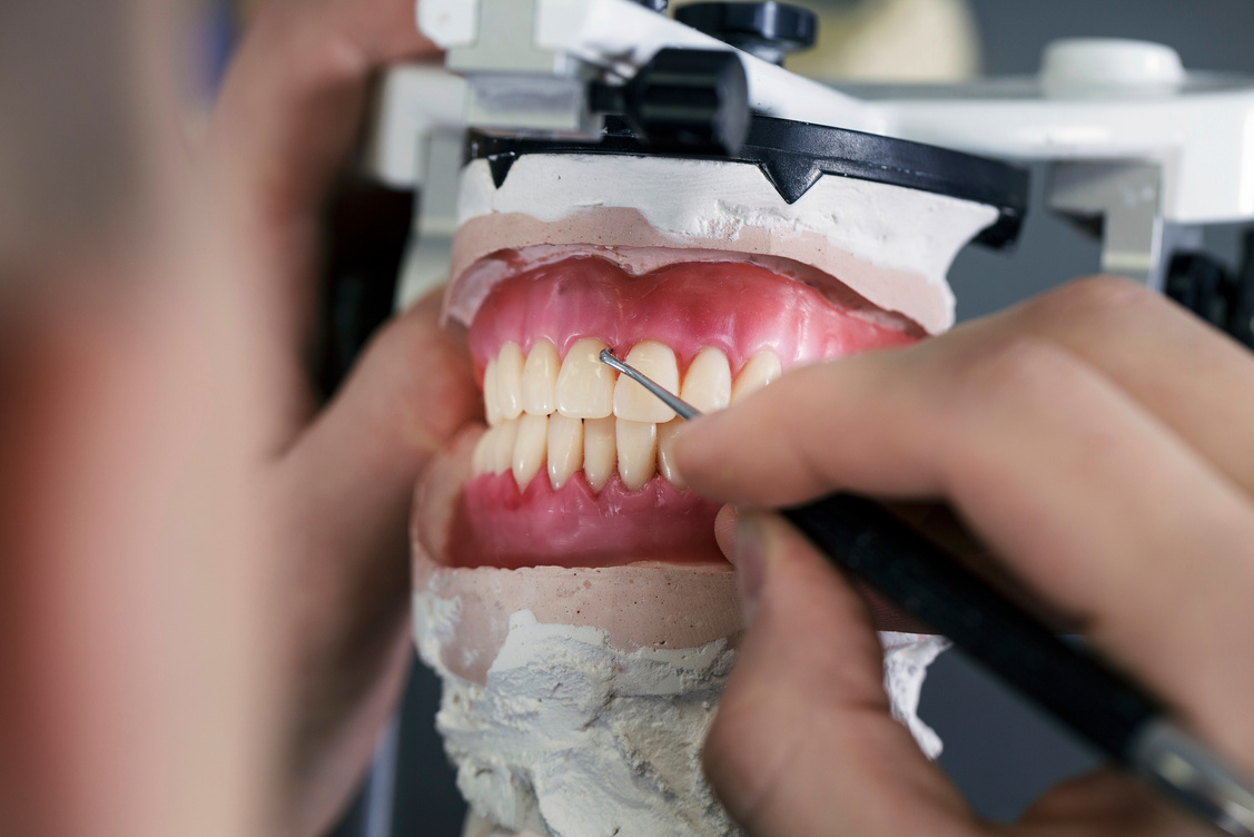Dental Technician Creates Removable Dental Prostheses with Pink